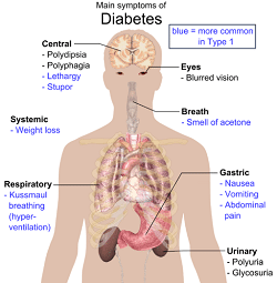 Diabetes and Your Health